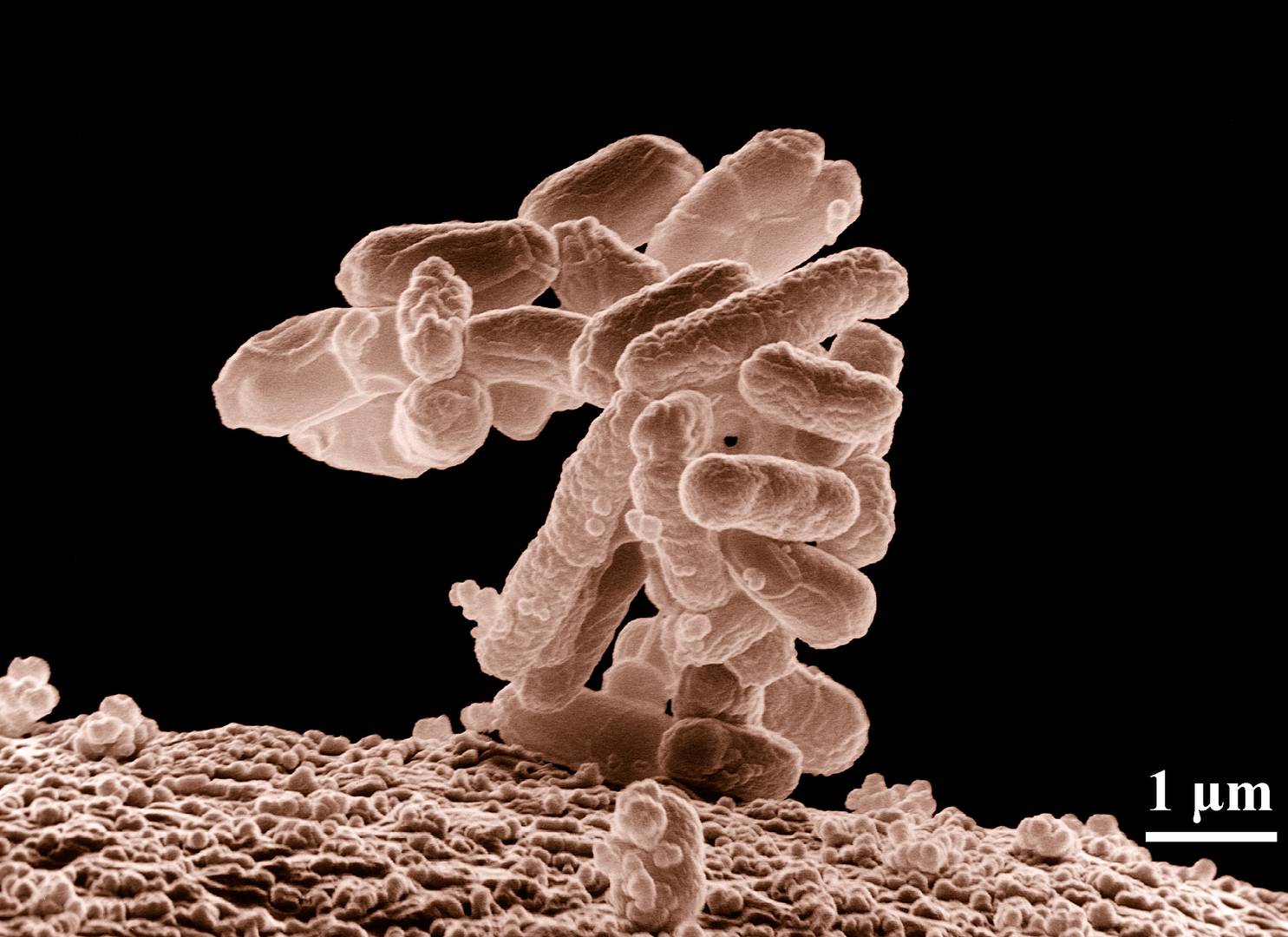 Патогенная бактерия E. coli (электронная микрофотография)