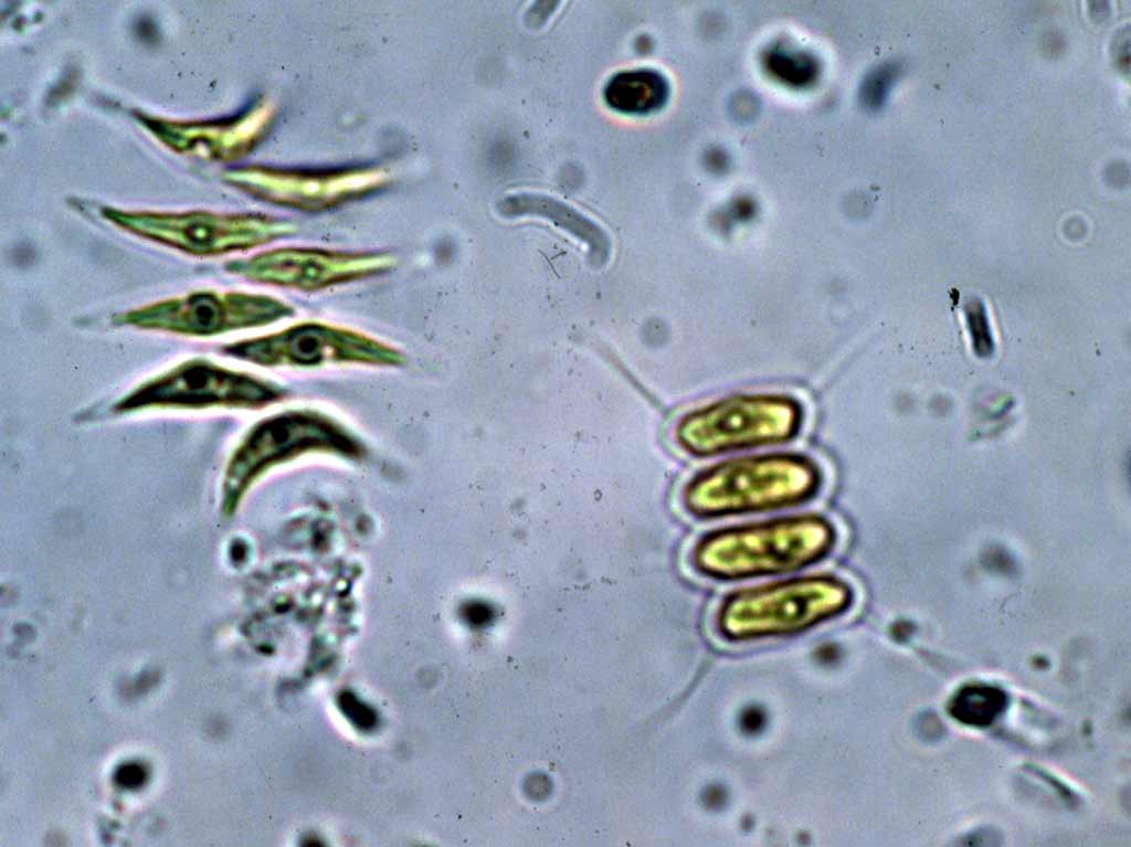 Scenedesmus quadricanda